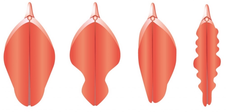 Пластика половых губ: этапы и особенности восстановительного процесса