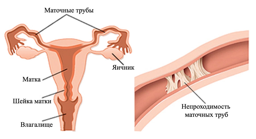 Сделать УЗИ и записаться на приём к гинекологу в платных клиниках Хабаровска